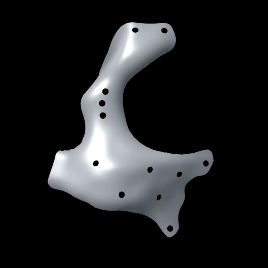 Reconstruction orbito-zygomatique
